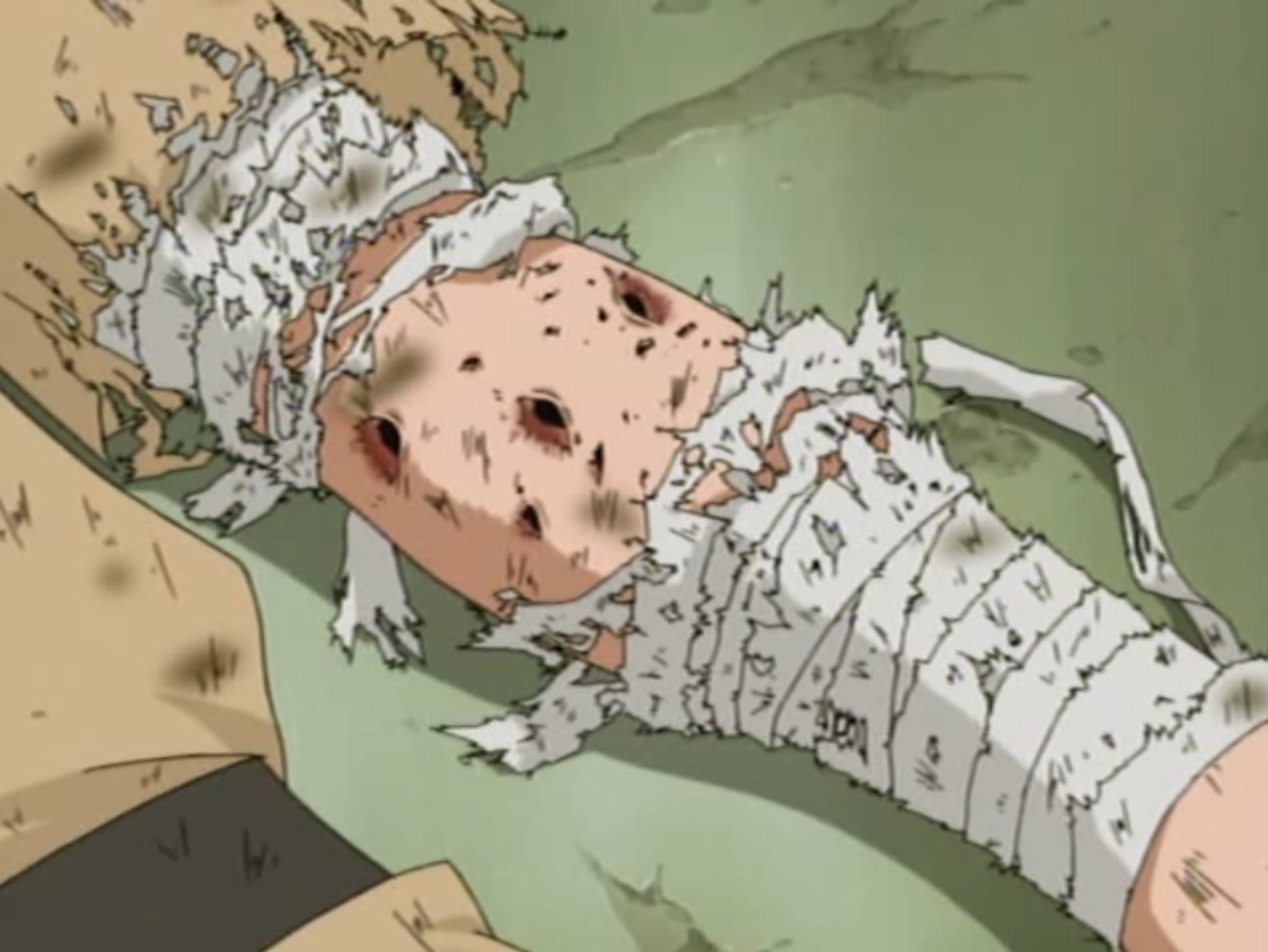 Esta cena do Exame Chunin de Naruto foi alterada no anime por conta da sua brutalidade