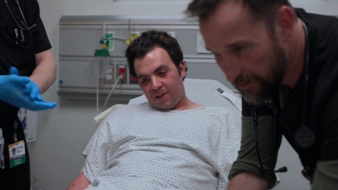 O que é a Queimadura de Margarita? Condição mostrada no episódio 8 da 2ª temporada de The Pitt